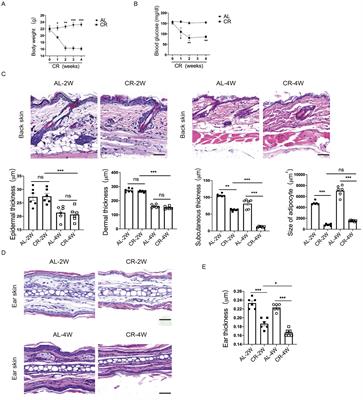 Caloric restriction impacts skin barrier function and attenuates the development of hyperplasia skin disease